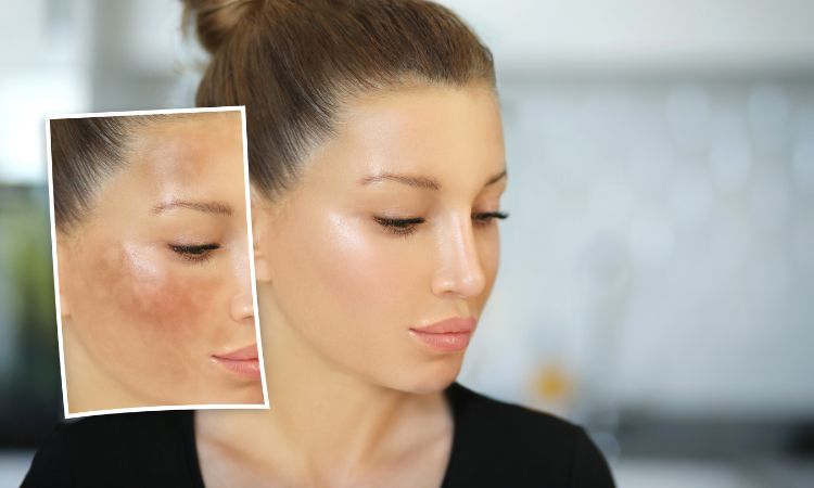 Which face wash is best for dark spots?